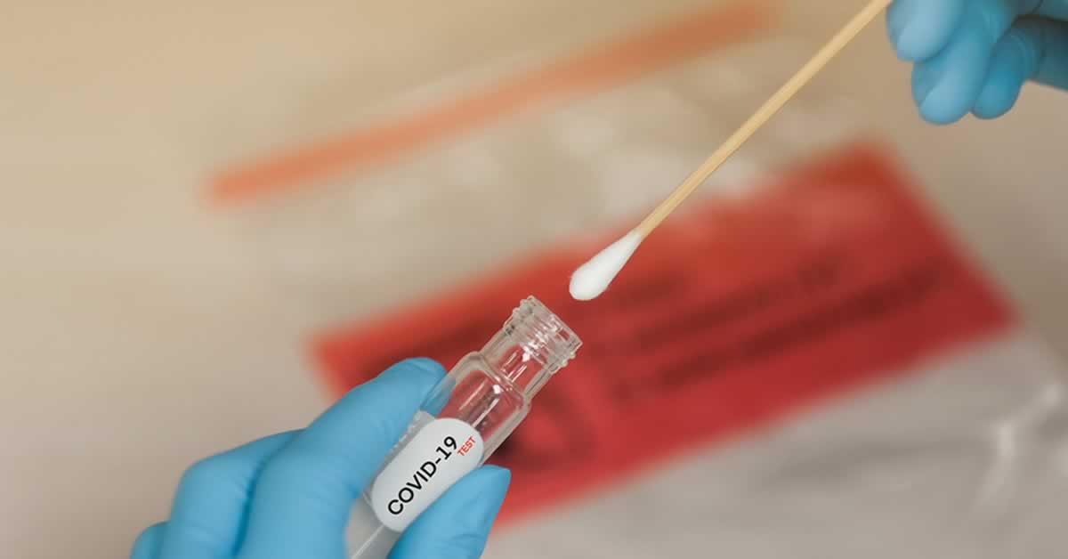 Covid-19: projeto quer garantir testes semanais para trabalhadores essenciais durante a pandemia